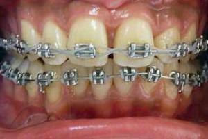 Orthodontie