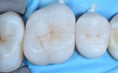 Dents soignées